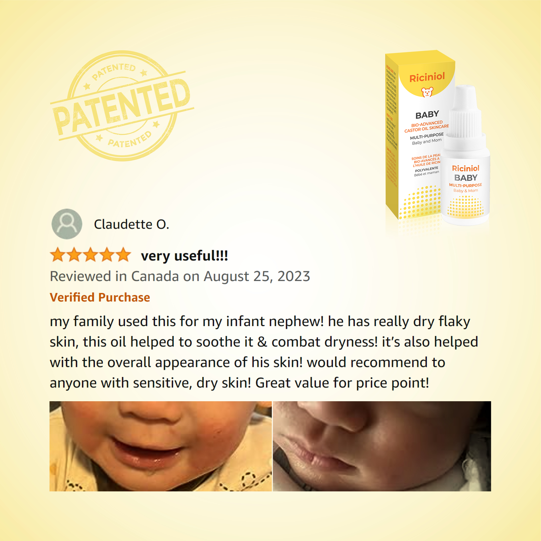 Riciniol Baby my family used this for my infant nephew! he has really dry flaky skin, this oil helped to soothe it & combat dryness! it’s also helped with the overall appearance of his skin! would recommend to anyone with sensitive, dry skin! Great value for price point!