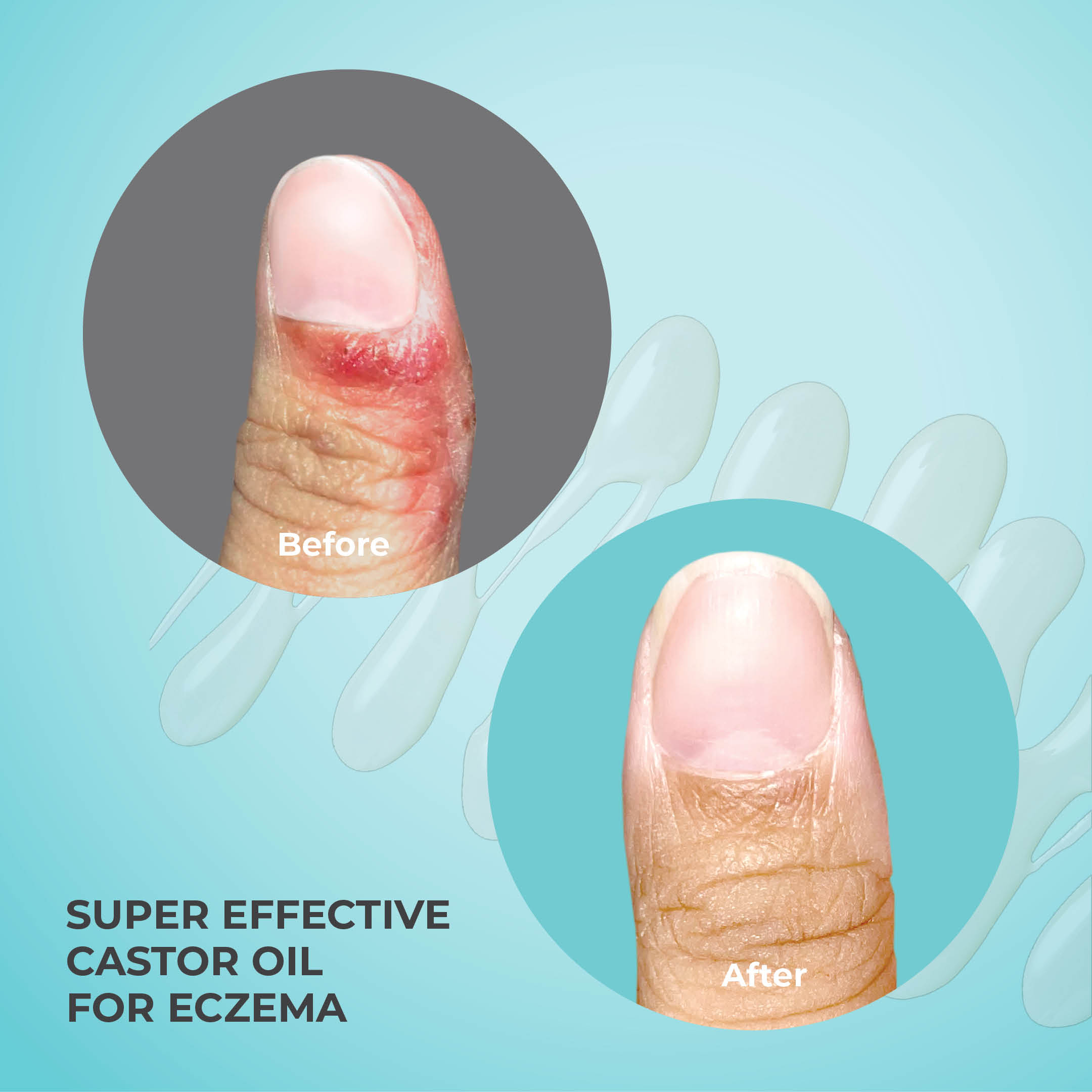 Hand Repair Essentials - Image 5